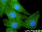 Dystrophin Antibody in Immunocytochemistry (ICC/IF)