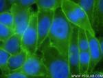 Dystrophin Antibody in Immunocytochemistry (ICC/IF)