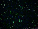 Dystrophin Antibody in Immunohistochemistry (PFA fixed) (IHC (PFA))