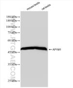 AP1M1 Antibody in Western Blot (WB)