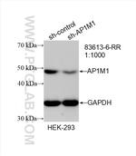 AP1M1 Antibody in Western Blot (WB)