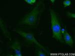 CNOT4 Antibody in Immunocytochemistry (ICC/IF)
