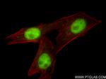 ZBTB7A Antibody in Immunocytochemistry (ICC/IF)
