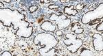 ZBTB7A Antibody in Immunohistochemistry (Paraffin) (IHC (P))