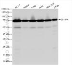 ZBTB7A Antibody in Western Blot (WB)