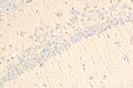 Presenilin-1 Antibody in Immunohistochemistry (Paraffin) (IHC (P))