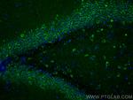 Presenilin-1 Antibody in Immunohistochemistry (PFA fixed) (IHC (PFA))