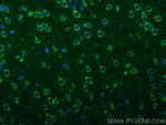 Presenilin-1 Antibody in Immunohistochemistry (PFA fixed) (IHC (PFA))