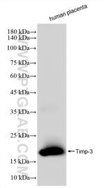 Timp-3 Antibody in Western Blot (WB)