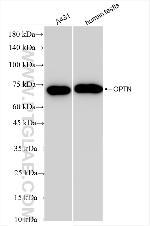 OPTN Antibody in Western Blot (WB)