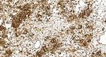 ATP6V1E1 Antibody in Immunohistochemistry (Paraffin) (IHC (P))
