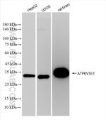 ATP6V1E1 Antibody in Western Blot (WB)