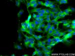 Synaptotagmin-1 Antibody in Immunocytochemistry (ICC/IF)