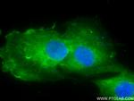 Synaptotagmin-1 Antibody in Immunocytochemistry (ICC/IF)