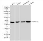 TADA1L Antibody in Western Blot (WB)