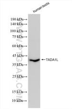 TADA1L Antibody in Western Blot (WB)