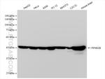 PIP4K2B Antibody in Western Blot (WB)