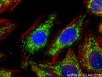 DLAT Antibody in Immunocytochemistry (ICC/IF)