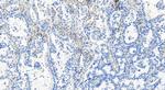 DLAT Antibody in Immunohistochemistry (Paraffin) (IHC (P))