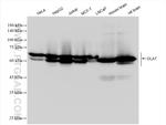 DLAT Antibody in Western Blot (WB)