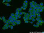PHKG2 Antibody in Immunocytochemistry (ICC/IF)
