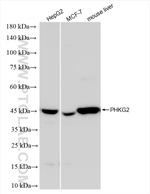 PHKG2 Antibody in Western Blot (WB)