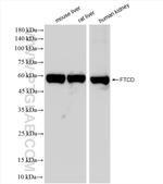 FTCD Antibody in Western Blot (WB)