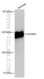 KCNH7 Antibody in Western Blot (WB)