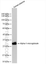 Alpha 1 microglobulin Antibody in Western Blot (WB)