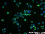 CHI3L1 Antibody in Immunocytochemistry (ICC/IF)