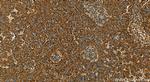 HSP47/SERPINH1 Antibody in Immunohistochemistry (Paraffin) (IHC (P))