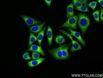MARS Antibody in Immunocytochemistry (ICC/IF)
