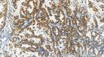 MARS Antibody in Immunohistochemistry (Paraffin) (IHC (P))