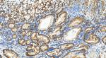 MARS Antibody in Immunohistochemistry (Paraffin) (IHC (P))