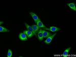 MARS Antibody in Immunocytochemistry (ICC/IF)