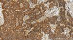 MARS Antibody in Immunohistochemistry (Paraffin) (IHC (P))