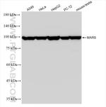MARS Antibody in Western Blot (WB)