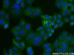 LRRC47 Antibody in Immunocytochemistry (ICC/IF)