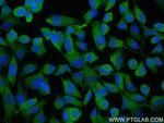 MTMR9 Antibody in Immunocytochemistry (ICC/IF)