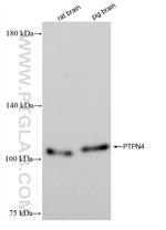 PTPN4 Antibody in Western Blot (WB)