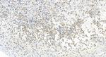 GALNT2 Antibody in Immunohistochemistry (Paraffin) (IHC (P))