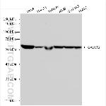 GALNT2 Antibody in Western Blot (WB)