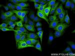 Beta galactosidase Antibody in Immunocytochemistry (ICC/IF)