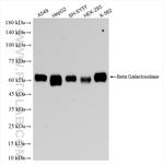 Beta galactosidase Antibody in Western Blot (WB)