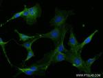 RAP1A Antibody in Immunocytochemistry (ICC/IF)