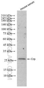 Crp Antibody in Western Blot (WB)
