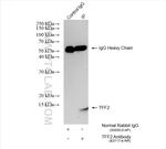 TFF2 Antibody in Immunoprecipitation (IP)