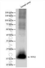 TFF2 Antibody in Western Blot (WB)
