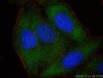 Apolipoprotein E Antibody in Immunocytochemistry (ICC/IF)