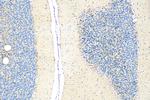 Apolipoprotein E Antibody in Immunohistochemistry (Paraffin) (IHC (P))